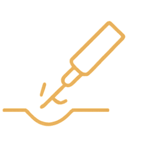 laser tattoo removal